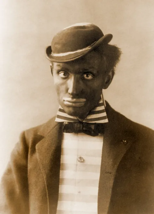 Framed Print : White man in blackface as minstrel. Minstrel theater drew on the genius of African-America art forms, but negatively stereotyped and ridiculed blacks. Ca. 1900 Framed Print : White man in blackface as minstrel. Minstrel theater drew on the genius of African-America art forms, but negatively stereotyped and ridiculed blacks. Ca. 1900