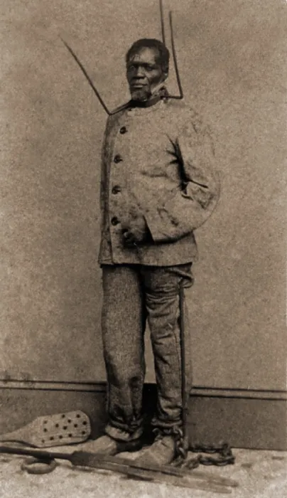 Framed Print : Wilson Chinn, a sixty year old former slave was branded on the forehead with his owner's initials, V. B