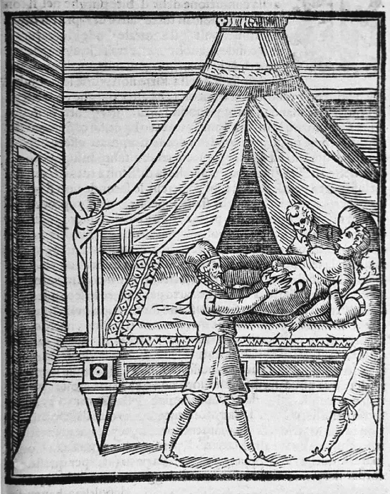 Framed Print : A woman lying on a bed is being restrained by two male assistants while the surgeon extracts the infant during a Cesarean section
