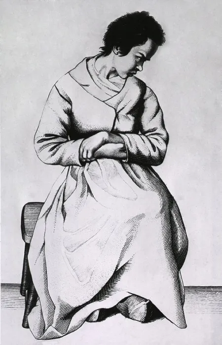 Framed Print : A woman with lypemania (melancholy or depression). From Etienne Esquirol's book describing the different types of mental disorders. Engraving by Ambroise Tardieu. 1838