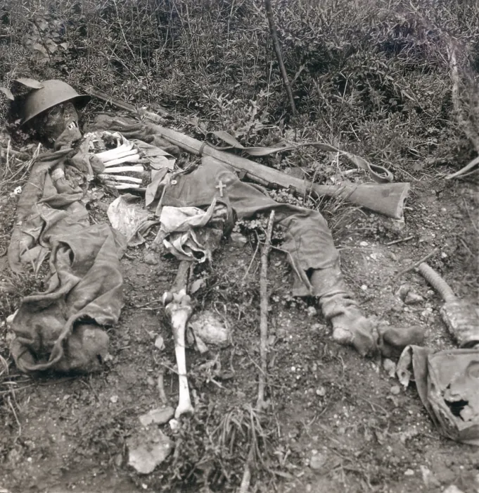 Framed Print : World War 1. Human wreckage in No Man's Land, Chemin des Dames, France. The remains of a British soldier on the battlefield during World War I. Ca. 1914-1915. (BSLOC_2013_2_9)