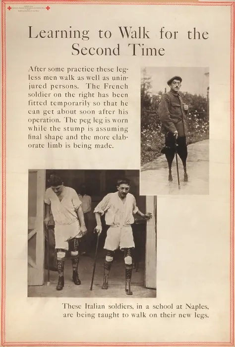 Framed Print : World War I, Red Cross Poster showing two scenes in which French and Italian soldiers with double leg amputations are being taught to walk with prostheses