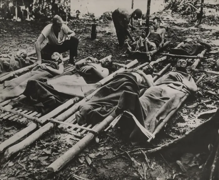 Framed Print : Wounded American soldiers waiting for treatment and evacuation in crude stretchers in New Guinea during World War II. 1943 Framed Print : Wounded American soldiers waiting for treatment and evacuation in crude stretchers in New Guinea during World War II. 1943