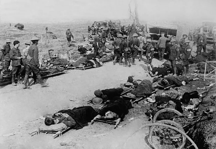 Framed Print : Wounded British soldiers on the battlefield near Ginchy, France, during World War 1 Somme Offensive, Sept. 1916