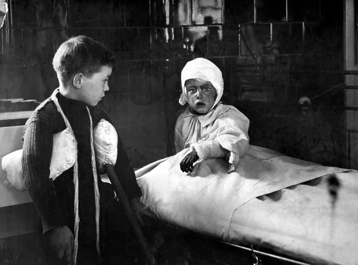 Framed Print : Wounded school children in a London hospital after a German World War I air raid. Ca. 1915 Framed Print : Wounded school children in a London hospital after a German World War I air raid. Ca. 1915