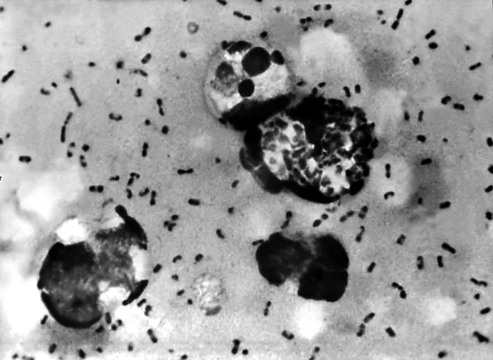 Framed Print : Yersinia pestis bacteria which caused Bubonic Plague. 1965 Framed Print : Yersinia pestis bacteria which caused Bubonic Plague. 1965