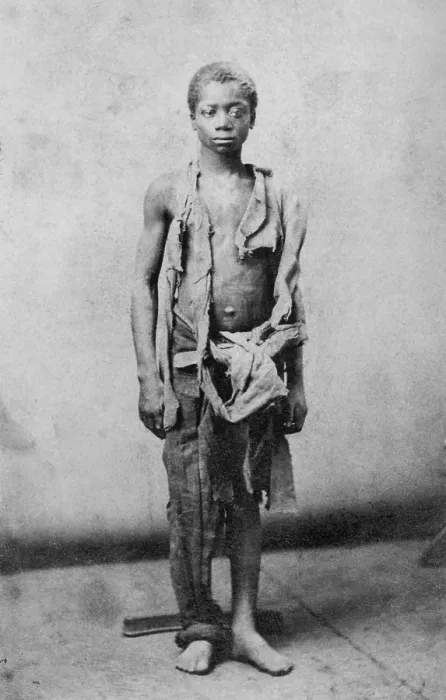 Framed Print : Young slave during the civil war reduced to such poverty he is wearing only rags. Ca. 1863. is wearing only rags. Ca. 1963. salem, Virginia