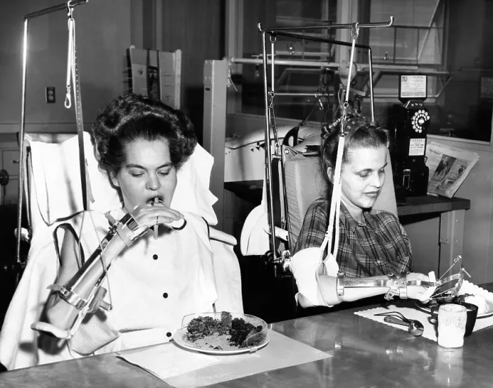 Framed Print : Two young women in rehabilitation after polio. They were both in Iron Lungs and are now feeding themselves with the help of special equipment