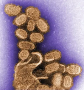 Microbiology Prints: 1918 influenza virions (virus particles)