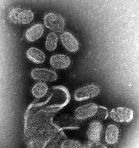 Medical Prints: 1918 influenza virions (virus particles)