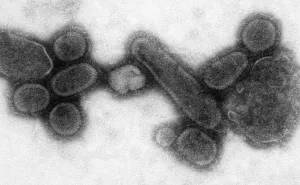 Medical Prints: 1918 influenza virions (virus particles)