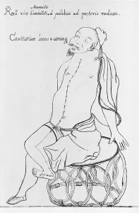 Woodcut Prints: Acupuncture points for treatment of kidney disorders on a seated, bearded Oriental man