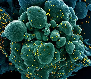 Digital Image Prints: Apoptotic cell (greenish brown) heavily infected with SARS-COV-2 virus particles (pink)