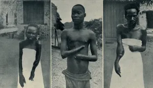 Forced Labor Prints: Atrocities of the Rubber Slavery in the Belgian Congo