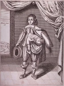 Curiosities Prints: Boy with a deformity caused by a partial conjoined twin growing from his side