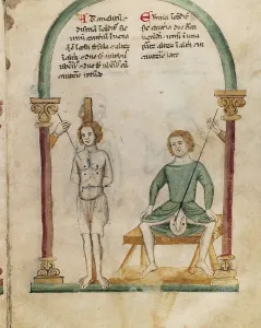 Healing Prints: Cauterization and preparation. Miniature