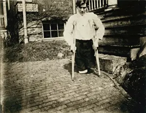West Virginia Prints: Child Labor, Frank, whose legs were cut off by a motor car in a coal mine in West Virginia when he was 14 years