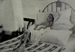 Famine Prints: Child victim of starvation in Cuba during the Cuban War of Independence, 1895-1898