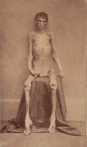 1860s Portrait Prints: The Civil War, A Federal prisoner