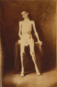 1860s Portrait Prints: The Civil War, A Federal prisoner