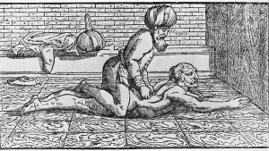 Patients Prints: Doctor massaging a patient's back