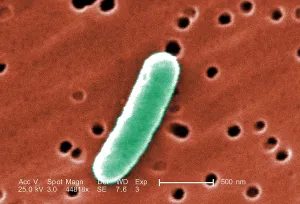 Microbiology Prints: E. coli, a common cause of bacterial diarrhea