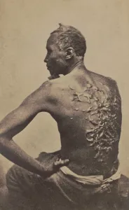 Slavery Prints: Escaped slave Gordon, showing his scarred back at a medical examination