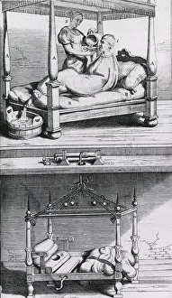 Patients Prints: Fever Bag of the 17th century