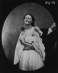 Guillaume Prints: Guillaume Duchenne (1806-1875), French physician, demonstrating the use of electrotherapy