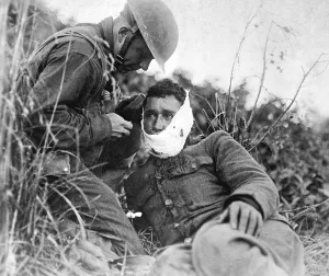 Bandages Prints: A just wounded American soldier