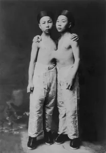 Curiosities Prints: Korean Siamese twins standing with hands on each others shoulders. 1903