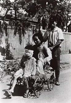 A Bomb Prints: Nagasaki atomic bomb survivors who have received some medical care
