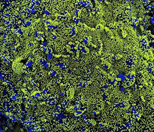 Epidemic Prints: Novel Coronavirus SARS-CoV-2