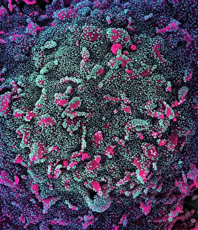 Epidemic Prints: Novel Coronavirus SARS-CoV-2
