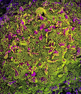 Epidemic Prints: Novel Coronavirus SARS-CoV-2