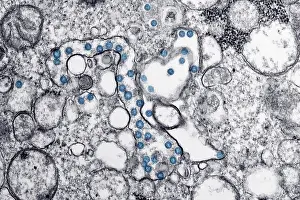 Illustration Prints: Novel Coronavirus SARS-CoV-2, also called