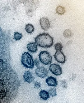 2020s Prints: Novel Coronavirus SARS-CoV-2, causes coronavirus disease-2019, abbreviated as COVID-19