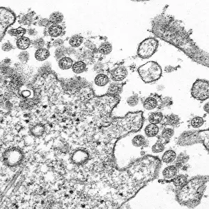 Illustration Prints: Novel Coronavirus SARS-CoV-2, causes coronavirus disease-2019, abbreviated as COVID-19