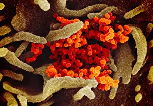 2020s Prints: Novel Coronavirus SARS-CoV-2, causes coronavirus disease-2019, abbreviated as COVID-19