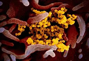 2020s Prints: Novel Coronavirus SARS-CoV-2, causes coronavirus disease-2019, abbreviated as COVID-19