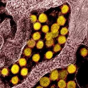 Digital Image Prints: Novel Coronavirus SARS-CoV-2, the virus that causes COVID19
