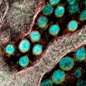 Digital Image Prints: Novel Coronavirus SARS-CoV-2, the virus that causes COVID19