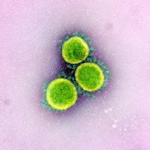 2020s Prints: Novel Coronavirus SARS-CoV-2, the virus that causes COVID19