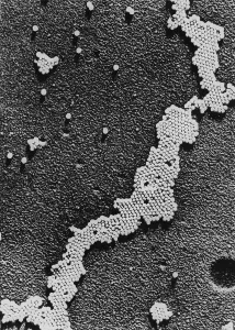 Illnesses Prints: Polio (Poliomyelitis) virus, the cause of Infantile Paralysis