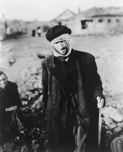 Russians Prints: Starved, almost blind Russian slave laborer at Nordhausen concentration camp