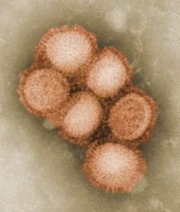 Microbiology Prints: Swine flu virus. Colorized negative stained transmission electron micrograph