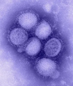 Microbiology Prints: Swine flu virus. Negative stained transmission electron micrograph