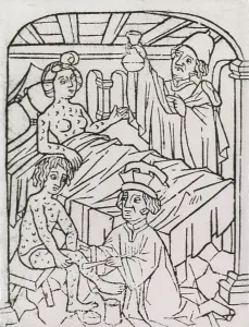 Patients Prints: Syphilis In Europe. A woman in bed and a man sitting on a stool are covered with venereal disease lesions