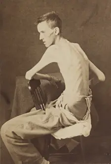 Three Quarter Length Prints: Union Private Jackson O. Brashears