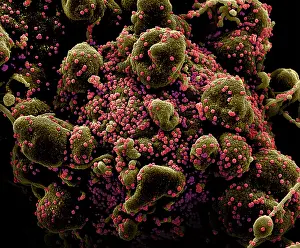 Digital Image Prints: VERO E6 cell (blue) heavily infected with SARS-COV-2 virus particles (orange)